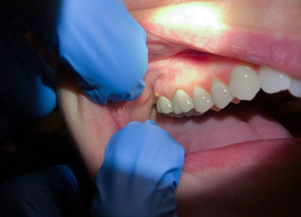 Best Emergency Cosmetic Dentistry in Riverdale, CA